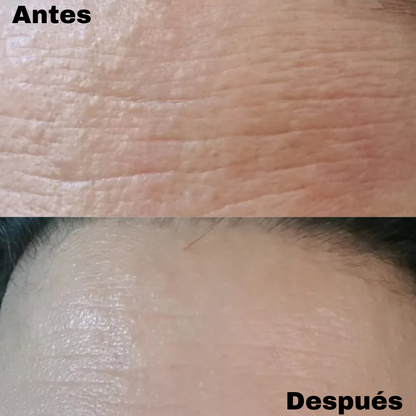 Restaura la juventud de tu piel con ciencia coreana!