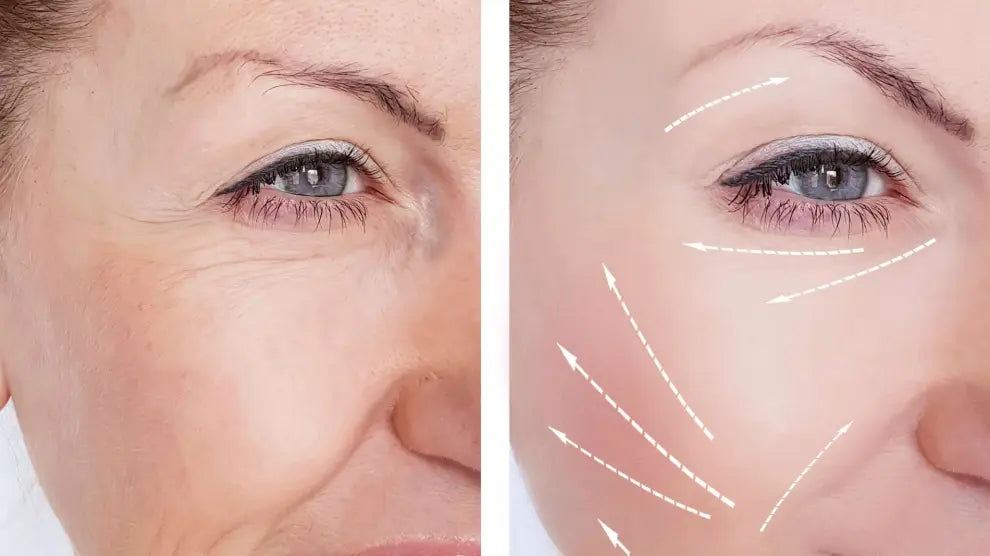 2 Cremas al Precio de 1 – "Hidratación y Luminosidad Garantizada!"